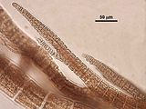 8 - Dettaglio delle cellule apicali e delle immediate derivate non ancora rivestite da periassiali
